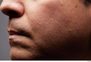 HD Face Skin Alan Laguna cheek face lips mouth nose…